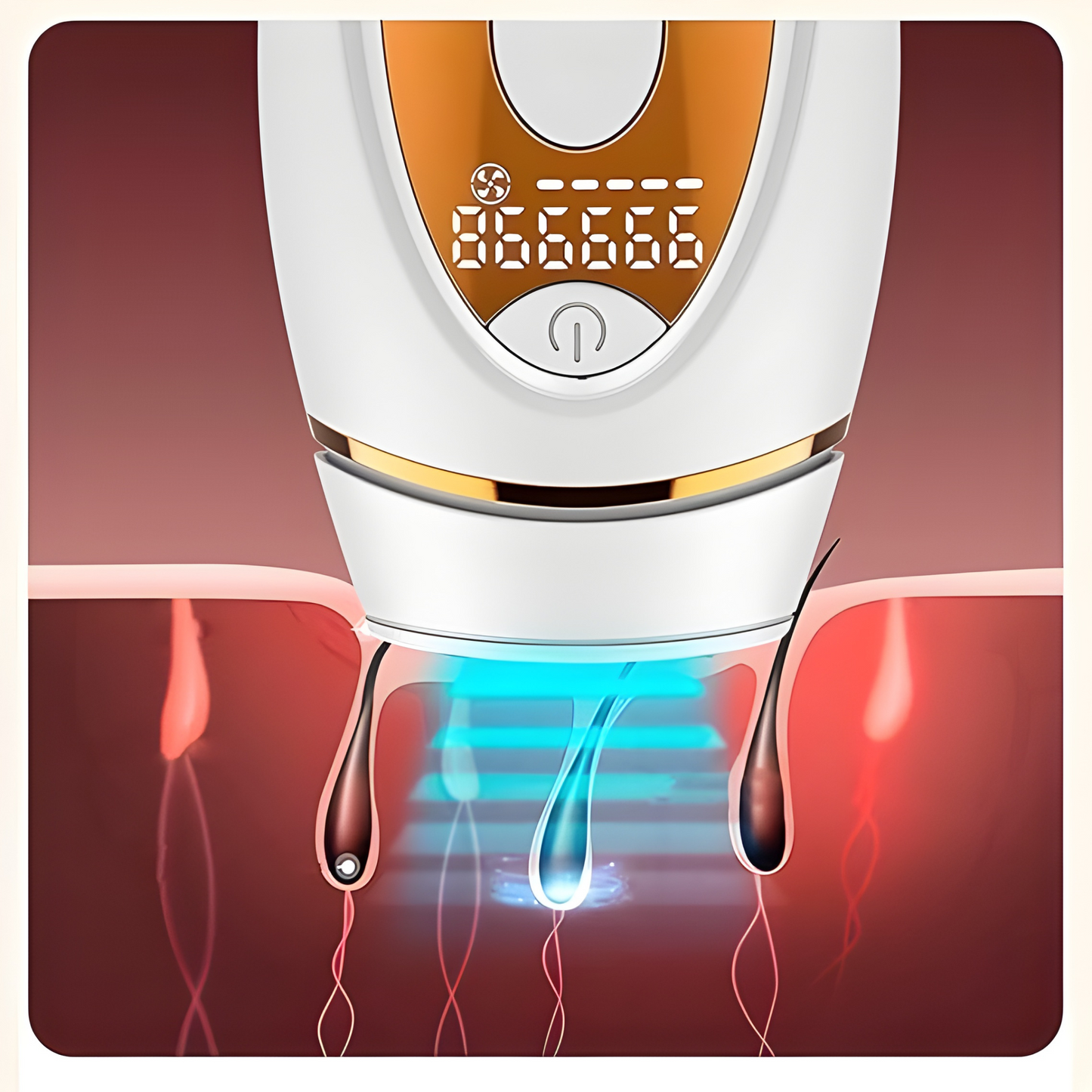 SilkBeam™ - Laser Hair Remover